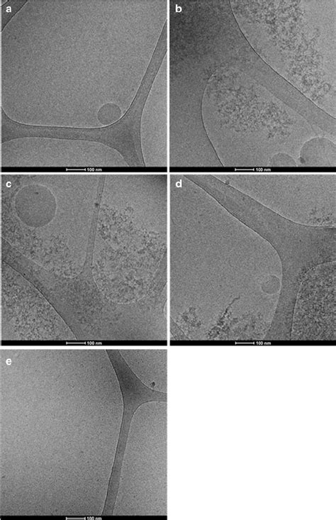 Cryo-TEM images of the inhibited samples of digestion medium during ...