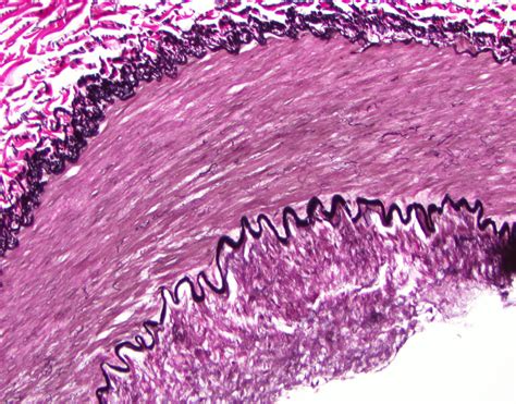 Muscular Artery Histology Labeled