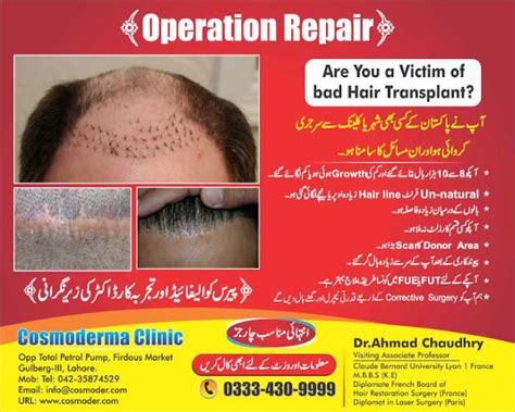 Hair Transplant Side Effects - Prevention