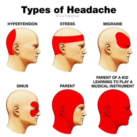 Types Of Headache Meme Template - Printable And Enjoyable Learning