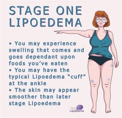 About Lipoedema