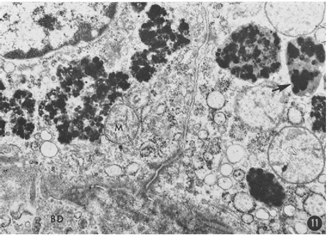 Figure 11 from LIPOFUSCIN (AGING) PIGMENT GRANULES OF THE NEWBORN HUMAN ...