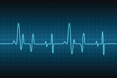 Heart Rate Out Of Rhythm Cheap Sale | gimnasiobilingueobregon.edu.co