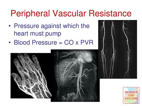 PPT - Shock More than just low blood pressure PowerPoint Presentation, free download - ID:1753617