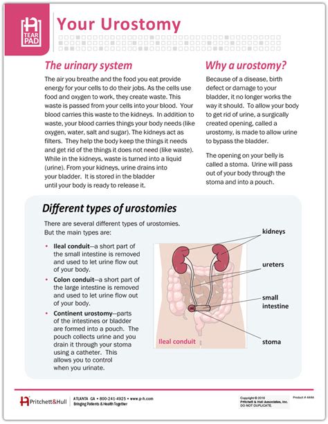 Your Urostomy Tearpad (50 sheets per pad) - Pritchett and Hull
