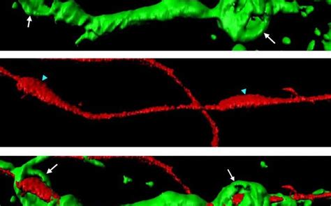 schwann cells News Research Articles