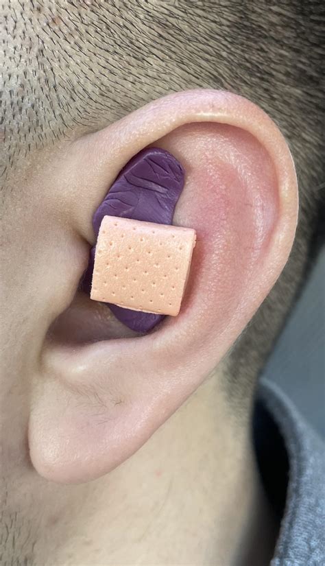 Behold, my self-made cauliflower ear compression contraption. : r/bjj