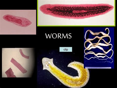 Guinea worms