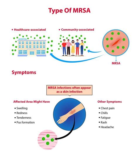 MRSA Facts, Symptoms, & Prevention Tips