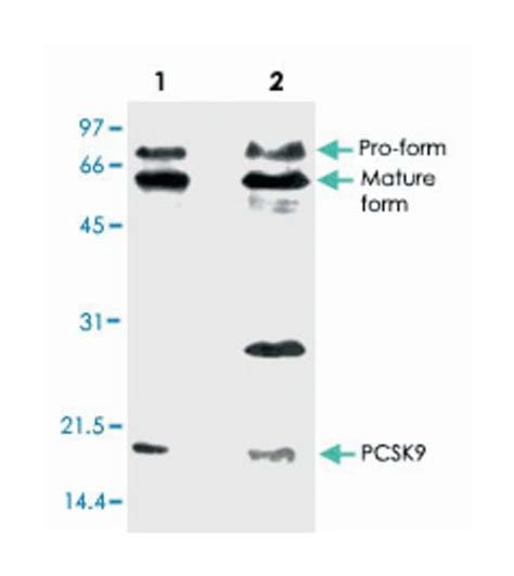 ANTI-PCSK9 ANTIBODY 100UG