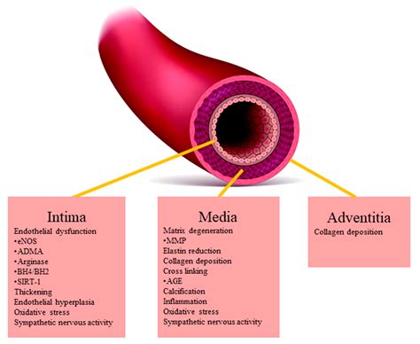 IJMS | Free Full-Text | Arterial Stiffness Assessed by Cardio-Ankle Vascular Index