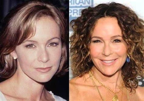 Jennifer Grey before and after plastic surgery (25) | Celebrity plastic ...