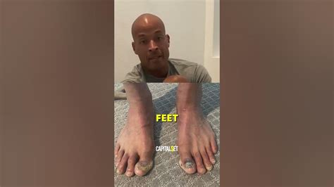 David Goggins' FEET After 23 YEARS Of RUNNING😳 - YouTube