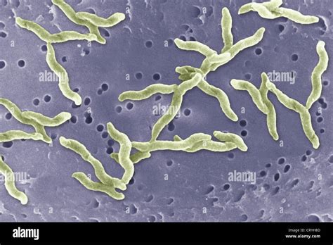 CAMPYLOBACTER JEJUNI Stock Photo - Alamy