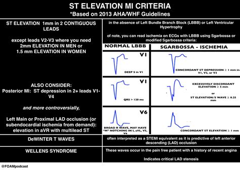 Pin by Lee Alaska on Cardio | Emergency medicine, Cardiovascular system, St elevation