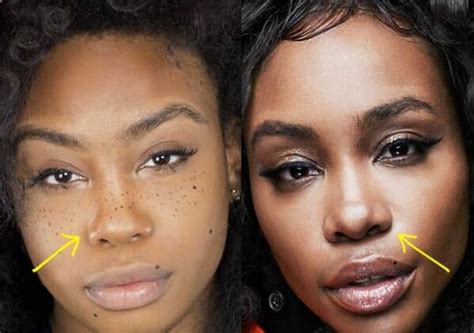 Sza Before Surgery See The Singer S Drastic Transform - vrogue.co