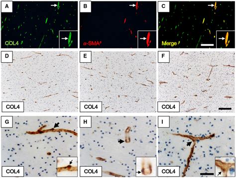 Quantification methods used for determining density of pericytes ...