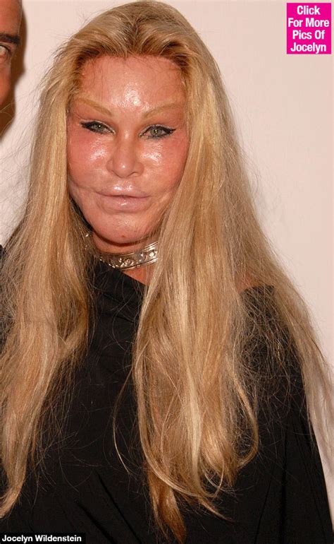 ‘Catwoman’ Jocelyn Wildenstein’s Mugshot Reveals New Plastic Surgery ...