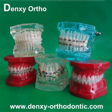 orthodontic model tooth model orthodontic braces teeth model - DY-M-01 - Denxy (China ...