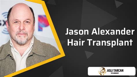 Jason Alexander Hair Transplant