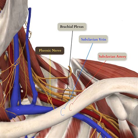 Pdf Lateral Approach For Supraclavicular Brachial Plexus Block | Porn ...