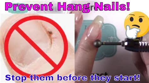 Hangnail Prevention That Really Works!! 🎉🎉🎉 - YouTube