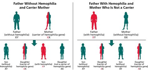 HEMOPHILIA: