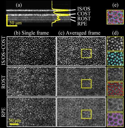 Adaptive optics OCT cross-sectional and en face images extracted from... | Download Scientific ...