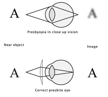 Presbyopia - Fantastic Optik