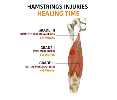 Running Hamstring Pain: Causes, Treatment and Prevention Plan