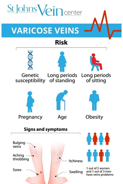 Varicose Veins 101 - A Guide to Varicose Vein Symptoms and Treatment ...