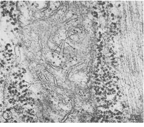 [PDF] ELECTRON MICROSCOPE STUDY OF MITOCHONDRIAL 60S AND CYTOPLASMIC ...