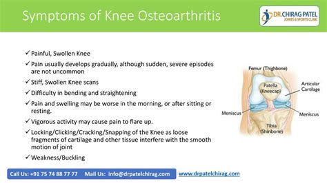 Symptoms Of Knee Osteoarthritis