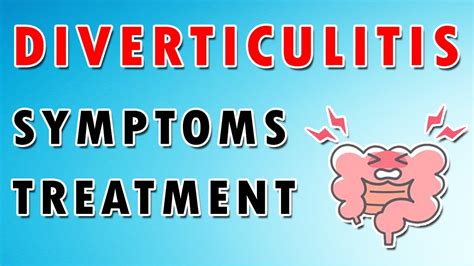 Diverticulitis Pain Relief: Effective Strategies for Comfort - YouTube