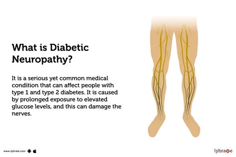 Diabetic Neuropathy: Treatment, Procedure, Cost, Recovery, Side Effects ...