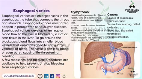 Esophageal varices