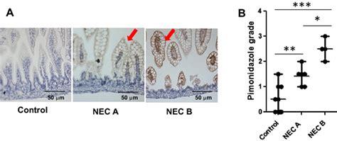 Pimonidazole staining by immunohistochemistry. a Pimonidazole staining ...