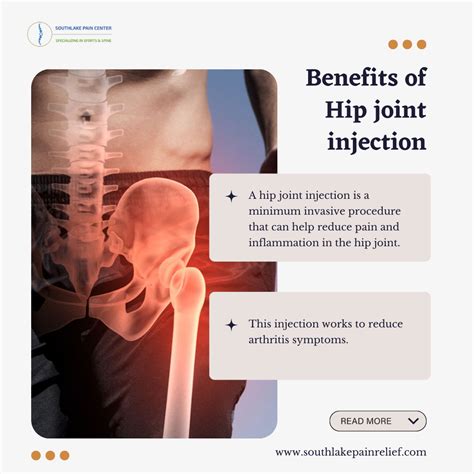 Hip Joint Injection – Preparation, Procedure, and Treatment in ...