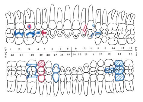 Image result for dental assistant study guide free | Dental assistant study, Dental charting ...