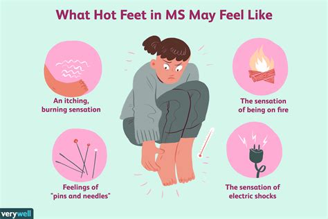 Hot Feet in MS: Symptoms, Causes, Diagnosis, and Treatment