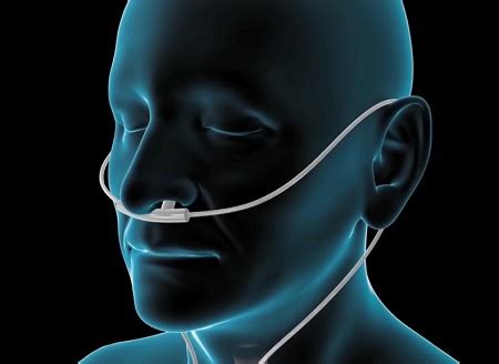 COPD (Chronic Obstructive Pulmonary Disease) - Diagnose-Me