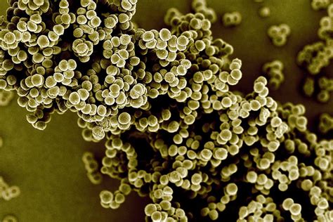 MRSA superbug’s resistance to antibiotics is broken | New Scientist