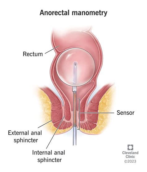 Anorectal Manometry: What It Is, Procedure Details & Results