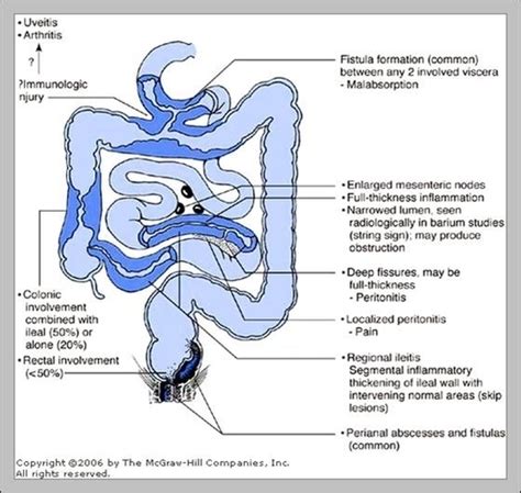 Terminal Ileum Anatomy Image - Graph Diagram