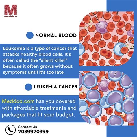 Cancer of the Blood: An information and educational blog about leukemia.