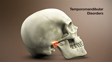 Temporomandibular joint Disorder – Symptoms, Causes, & Treatment