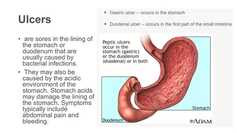 Digestive system diseases.pptx | Free Download