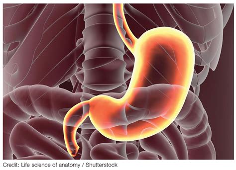 Zollinger-Ellison Syndrome: Not Your Average Peptic Ulcer Disease | Clinician Reviews