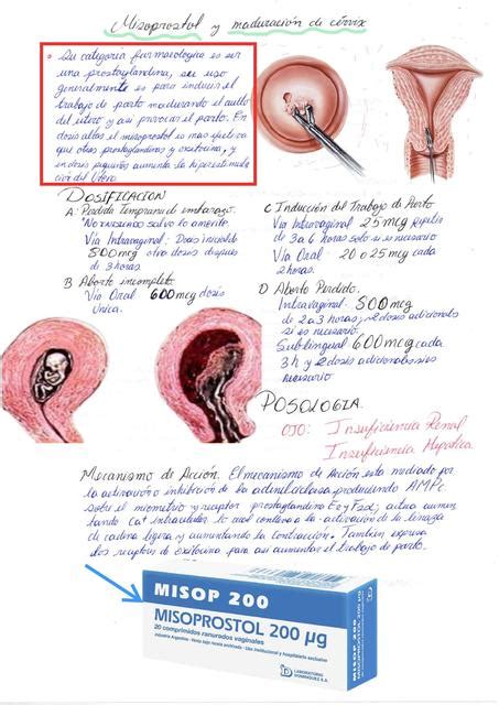 Misoprostol y Maduración del Cérvix | RUTH MICHALLI VARGAS CANDIA | uDocz