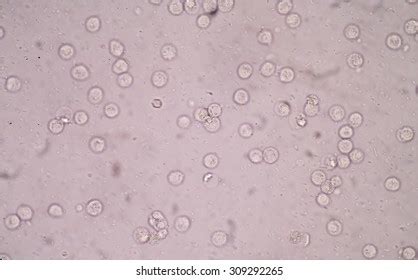 341 White blood cell in urine 이미지, 스톡 사진 및 벡터 | Shutterstock